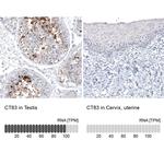 CT83 Antibody