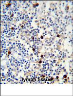 Lambda light chain Monoclonal Antibody (HP6054)