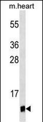 UBL5 Monoclonal Antibody (429CT16.3.1)