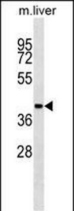 AHCY Monoclonal Antibody (445CT13.3.3)