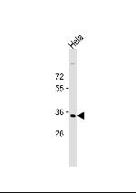 STRA8 Monoclonal Antibody (526CT11.1.5)