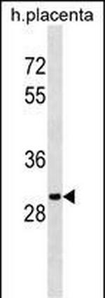 OR5B12 Antibody in Western Blot (WB)