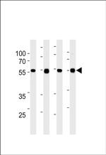 TPTE2 Monoclonal Antibody (978CT6.1.4)