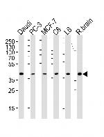 CREB3L4 Monoclonal Antibody (1165CT16.1.1)