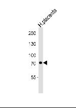 Calpain 6 Monoclonal Antibody (1395CT446.22.5)