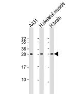 DENR Antibody in Western Blot (WB)