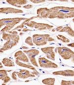 MKRN2 Antibody in Immunohistochemistry (Paraffin) (IHC (P))