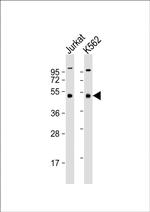 MKRN2 Antibody in Western Blot (WB)
