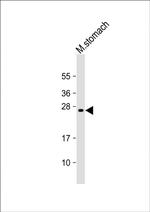 RAB27B Antibody in Western Blot (WB)