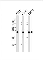 RAB5C Monoclonal Antibody (1616CT314.65.31)