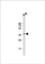 RASSF2 Monoclonal Antibody (1509CT269.10.9.29)