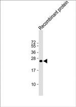 KMT2C Monoclonal Antibody (1686CT202.60.69)