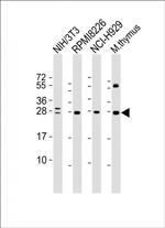 FGFR1OP2 Monoclonal Antibody (1675CT713.89.84)