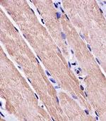 MYO18B Monoclonal Antibody (1683CT270.39.50)
