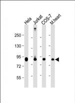 PFKP Antibody in Western Blot (WB)