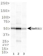 RAD51B Monoclonal Antibody (1 H3/13)