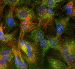 ABCG8 Monoclonal Antibody (1B10A5)