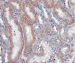 VLDLR Antibody in Immunohistochemistry (Paraffin) (IHC (P))