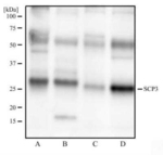SCP3 Antibody in Western Blot (WB)