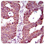 ABCG5 Antibody in Immunohistochemistry (Paraffin) (IHC (P))