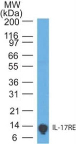 IL17RE Antibody in Western Blot (WB)
