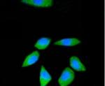 RPS3 Recombinant Rabbit Monoclonal Antibody (3D5)