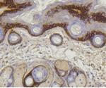 COL17A1 Antibody in Immunohistochemistry (Paraffin) (IHC (P))