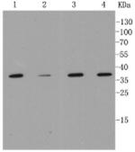 MMP12 Recombinant Rabbit Monoclonal Antibody (1C11)