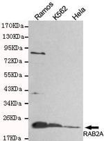 RAB2A Antibody in Western Blot (WB)