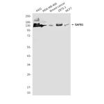 SAFB Monoclonal Antibody (8E6)
