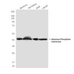 MPI Monoclonal Antibody (4E1)