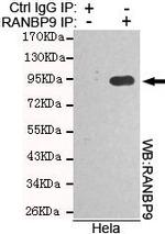 RANBP9 Antibody in Immunoprecipitation (IP)