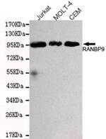 RANBP9 Antibody in Western Blot (WB)