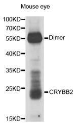 CRYBB2 Polyclonal Antibody