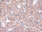 PTCH Antibody in Immunohistochemistry (Paraffin) (IHC (P))
