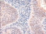 PTCH Antibody in Immunohistochemistry (Paraffin) (IHC (P))