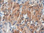 PTCH Antibody in Immunohistochemistry (Paraffin) (IHC (P))