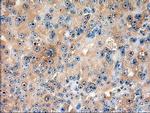 PTCH Antibody in Immunohistochemistry (Paraffin) (IHC (P))