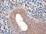 PTCH Antibody in Immunohistochemistry (Paraffin) (IHC (P))