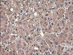 PTCH Antibody in Immunohistochemistry (Paraffin) (IHC (P))