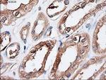 PTCH Antibody in Immunohistochemistry (Paraffin) (IHC (P))