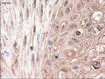 PTCH Antibody in Immunohistochemistry (Paraffin) (IHC (P))
