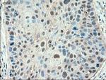 PTCH Antibody in Immunohistochemistry (Paraffin) (IHC (P))