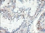 PTCH Antibody in Immunohistochemistry (Paraffin) (IHC (P))