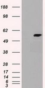 CYP7B1 Antibody in Western Blot (WB)