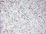 USP13 Monoclonal Antibody (OTI4G1)