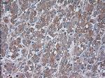 TRPM4 Monoclonal Antibody (OTI14C3)
