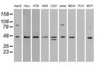 SSB Antibody in Western Blot (WB)