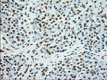 SSB Antibody in Immunohistochemistry (Paraffin) (IHC (P))