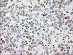 SSB Antibody in Immunohistochemistry (Paraffin) (IHC (P))